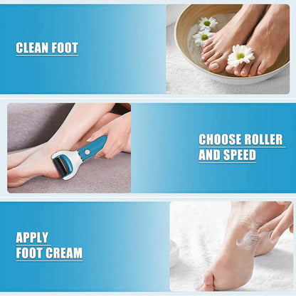 Blue Electric File - Conjunto de manicure e pedicure para remoção de pele dura e cuidados com os pés