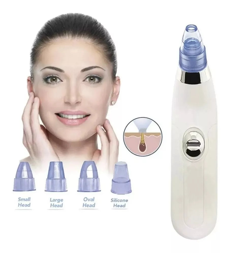 USB Pro Blackhead Suction Machine - Removes Acne, Oil and Cleans Pores with 4 Interchangeable Heads